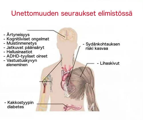 Miksi Unen Puute Aiheuttaa Naposteluhimoa?